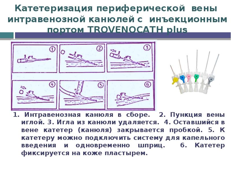 В вену ставят