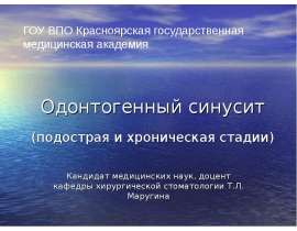 Одонтогенный синусит