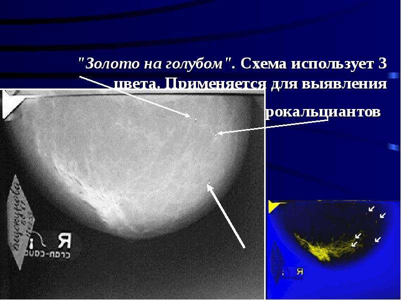 Исследование молочных желез. Лучевые методы исследования молочной железы. Методы обследования молочной железы презентация. Фон для презентации методы обследования молочной железы. Лучевая язва на молочной железе.