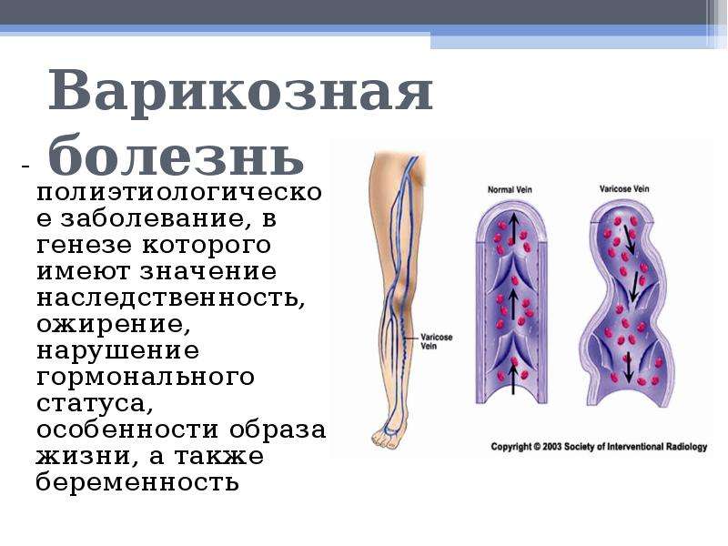 Заболевания сосудов