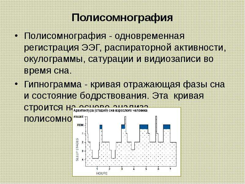 Полисомнография. Гипнограмма. Фоновая электрическая активность физиология. Что показывает полисомнография. Регистрации сна полисомнография физиология.