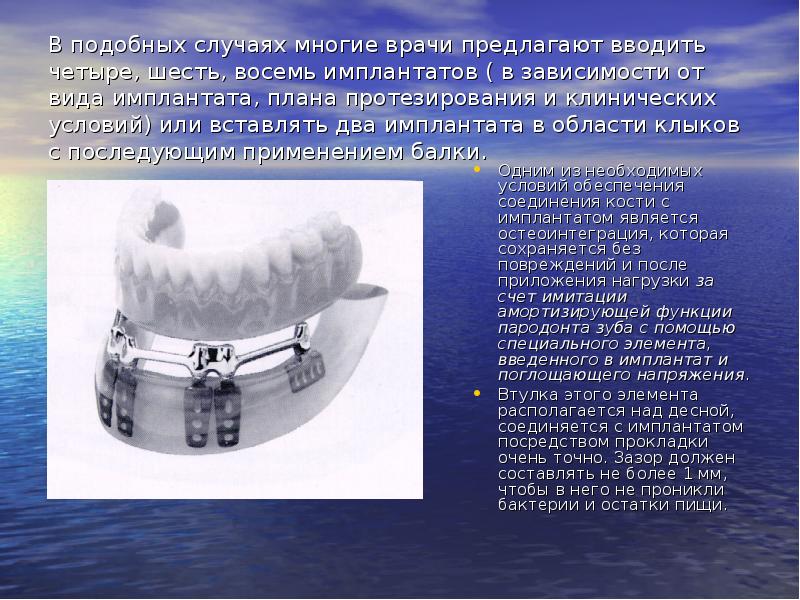 Подобный случай. Мастерские для протезирования план. Врач с имплантом кости на заводе.