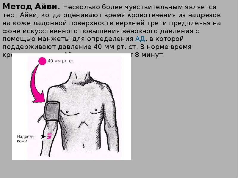 Несколько более. Метод Айви. Метод Айви время кровотечения. Длительность кровотечения по Айви. Кровотечения по Айви норма.