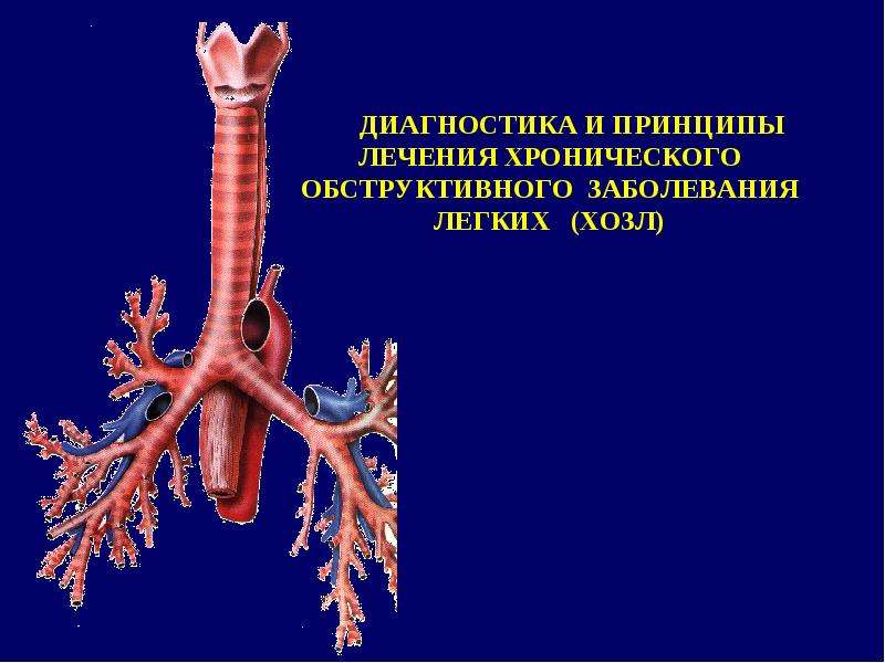 Самые легкие презентации