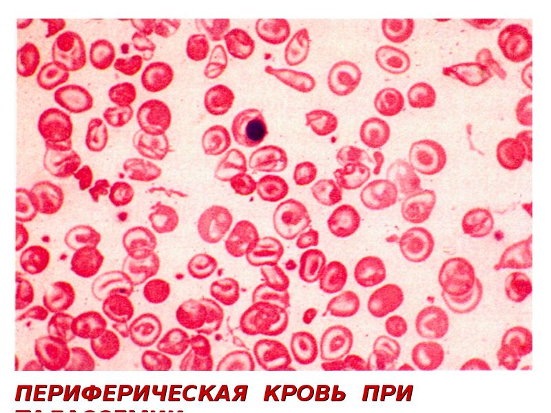 Патология красной крови патофизиология презентация