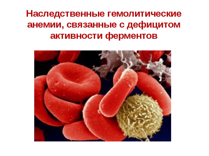 Патологии ферментов. Патология красной крови презентация. Несфероцитарная гемолитическая анемия.