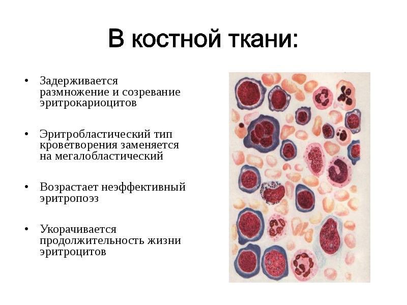 Патология крови презентация