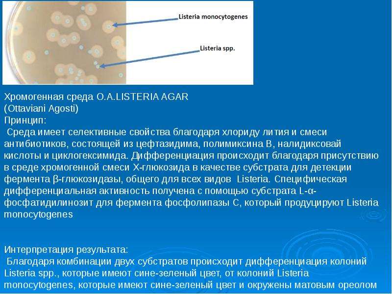 Listeria monocytogenes что это