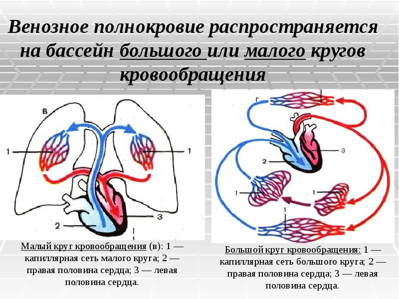 Схема нарушения кровообращения