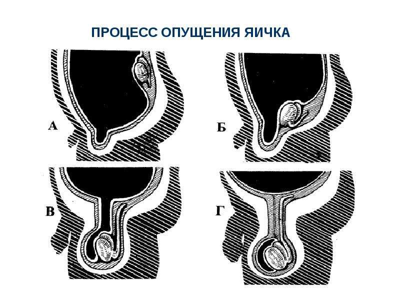 Грыжи живота презентация скачать