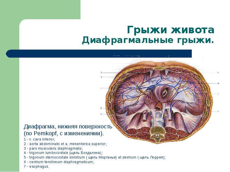 Грыжи живота госпитальная хирургия презентация