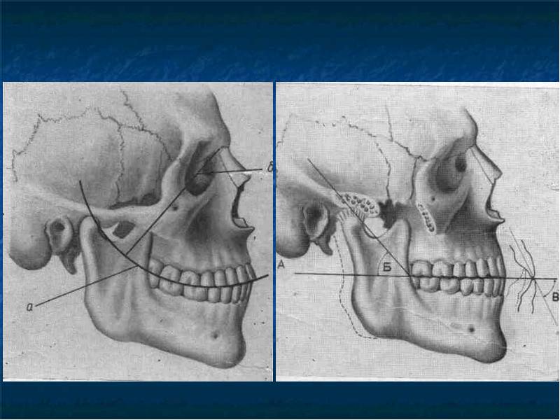 Подвижное соединение челюстей. На что крепится нижняя челюсть. Крепление нижней челюсти. Нижняя челюсть крепится к черепу.