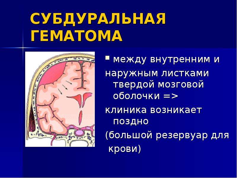 Профилактика гематом