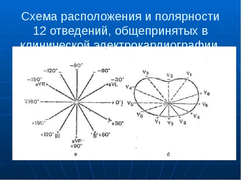 Ниже представлена фотография фрагмента электрокардиограммы и увеличенный снимок одного из сердечных