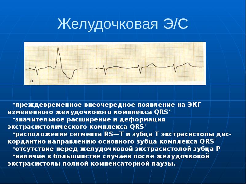 Ниже представлена фотография фрагмента электрокардиограммы и увеличенный снимок одного из сердечных