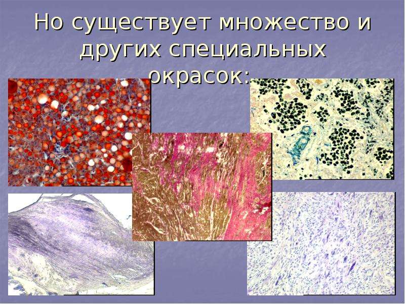 Чума патологическая анатомия презентация