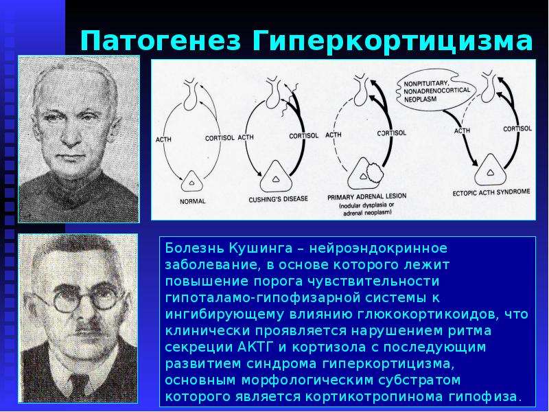 Патогенез гиперкортицизма схема