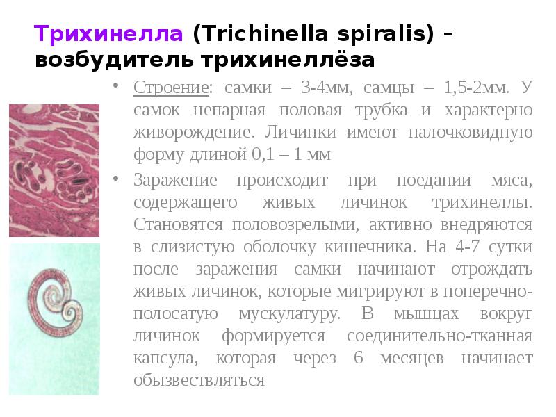 Строение трихинеллы рисунок