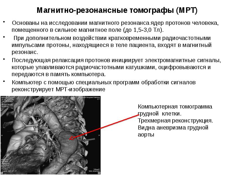 Получение изображений при мрт основано на сигналах от ядер