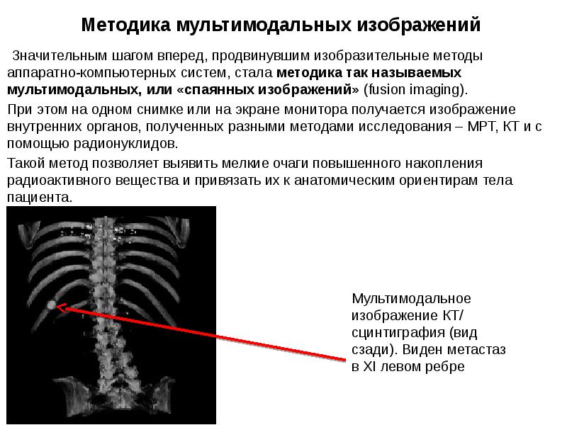 Мультимодальное спаянное изображение получается при