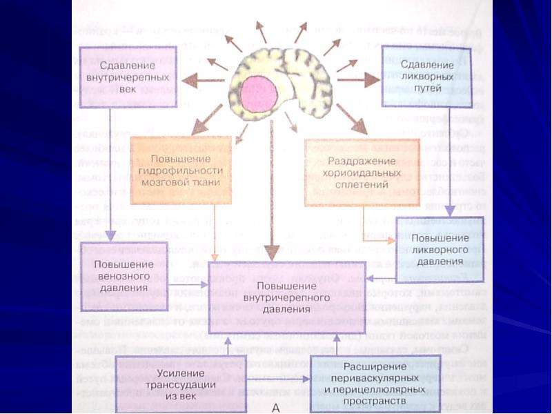 Опухоли цнс у детей презентация