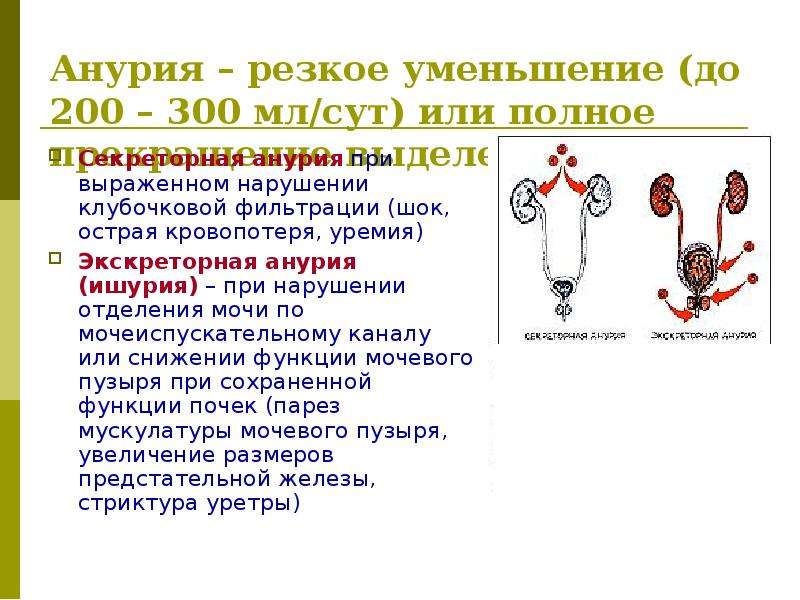 Анурия это в медицине. Анурия. Анурия у детей. Рефлекторная анурия. Секреторная анурия это.