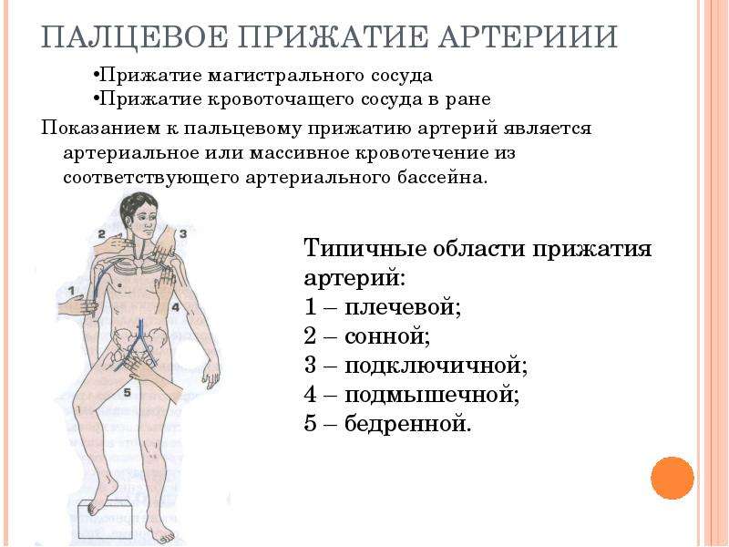 Картинки пальцевое прижатие артерии