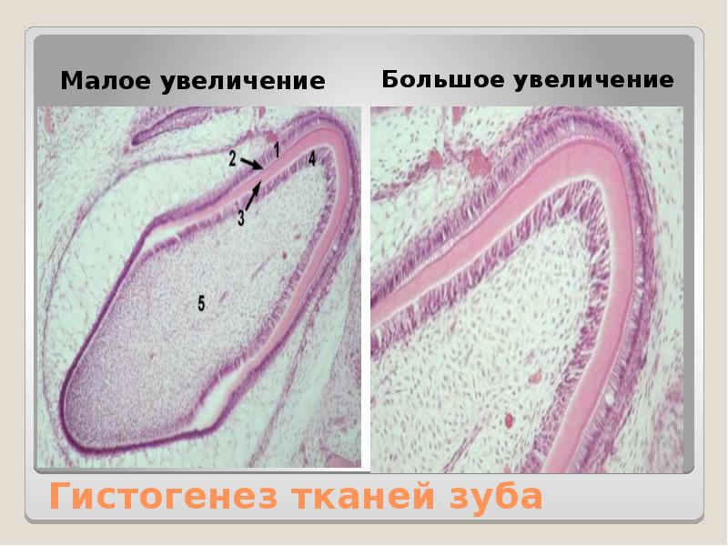 Поздняя стадия развития зуба гистология рисунок