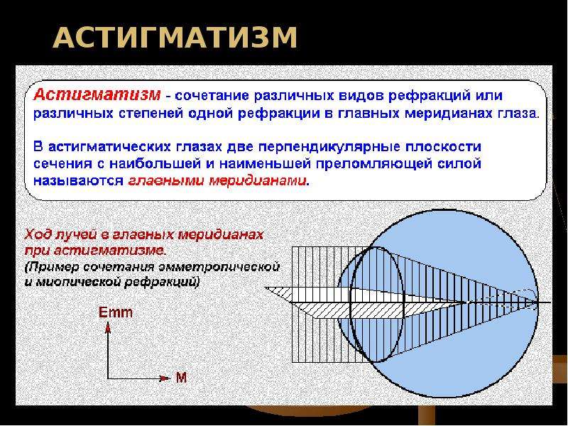 Рефракция в двух главных меридианах. Астигматизм. Главные меридианы астигматического глаза это. Астигматизм ход лучей. Рефракционный астигматизм.