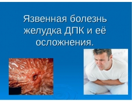 Язвенная болезнь желудка ДПК и её осложнения