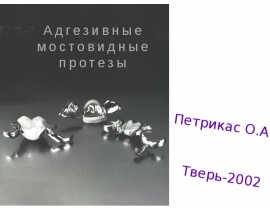 Адгезивные мостовидные протезы