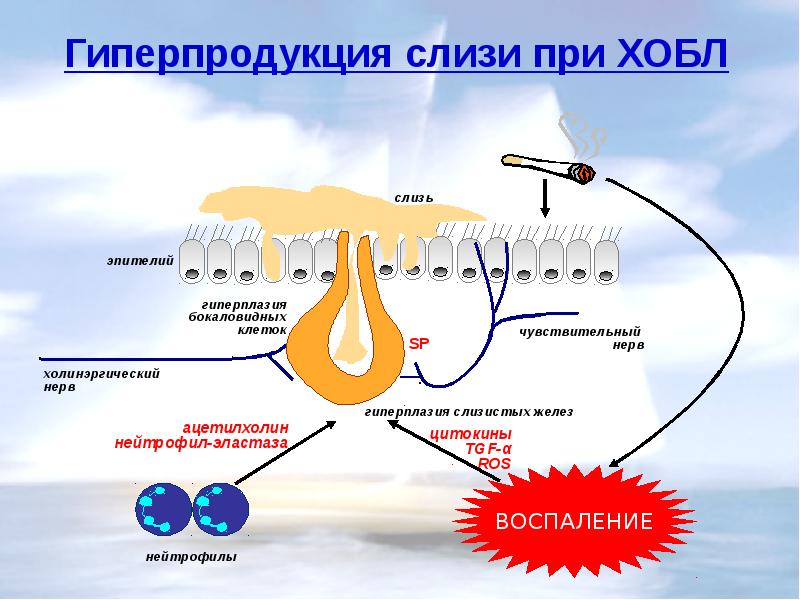 Презентация на тему хронический бронхит