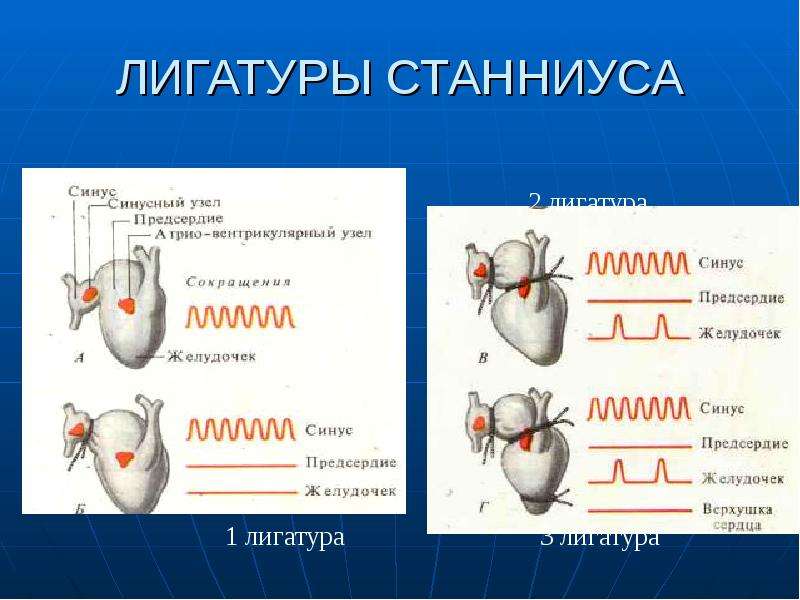 Схема наложения лигатур