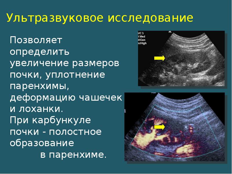 Признаки паренхимы