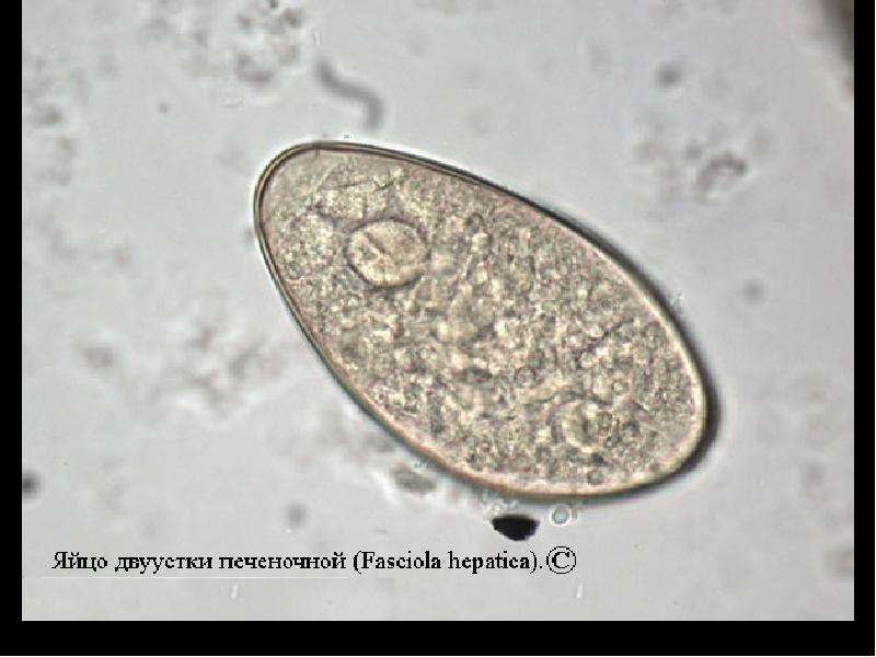 Печеночная д. Яйца гельминтов Fasciola hepatica. Fasciola hepatica яйца. Яйца печеночного сосальщика микроскоп. Яйца печеночной двуустки.