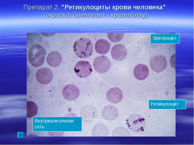 Ретикулоциты в мазке фото