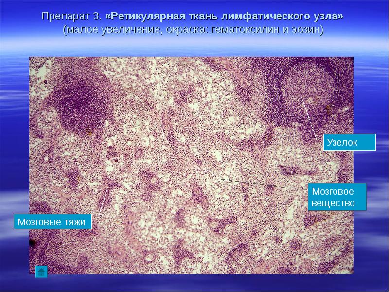 Малое увеличение. Ретикулярная ткань лимфатического узла препарат гистология. Ретикулярная ткань гистология.