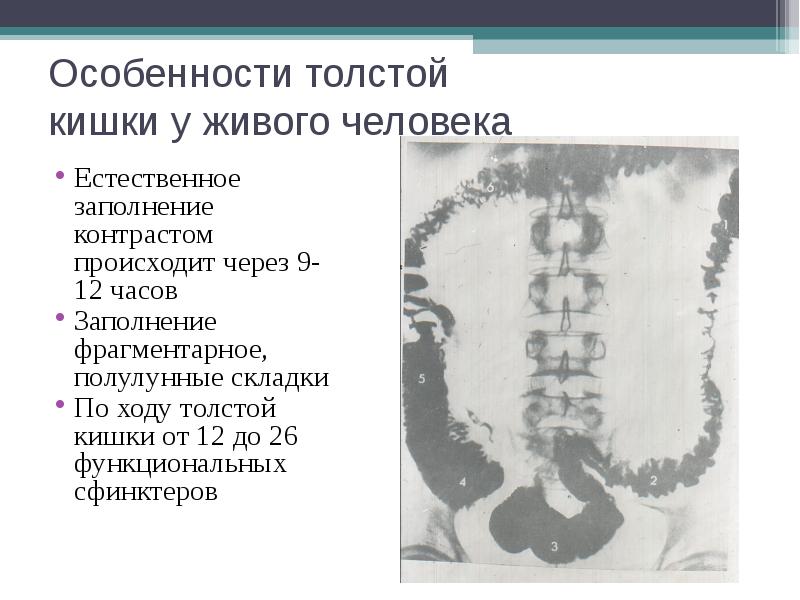 Сфинктеры кишечника человека схема