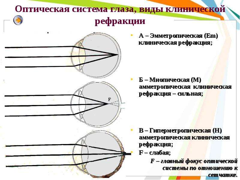 Задней вершинной рефракции