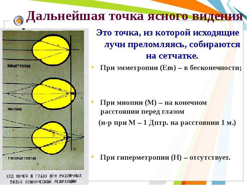 Ближняя точка зрения. Ближайшая точка ясного видения миопия. Определение дальнейшей точки ясного зрения. • Положение дальнейшей точки ясного видения. Дальнейшая точка ясного видения это точка.