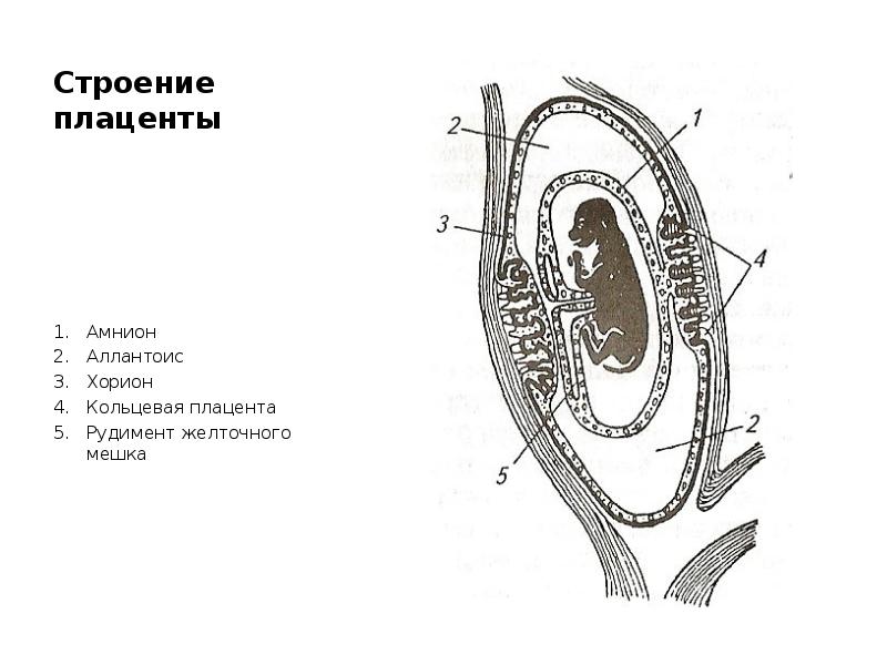 Кольцевой стенок. Кольцевидная плацента при беременности. Хорион плацента кольцевидный. Кольцевидное расположение хориона. Локализация хориона плаценты Кольцевая.