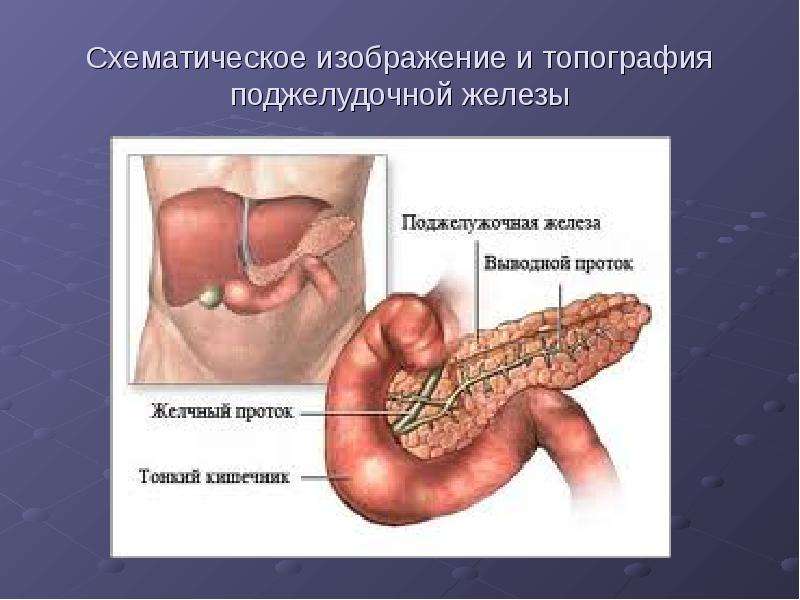 Трансплантация поджелудочной железы презентация