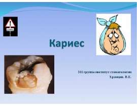 Кариес