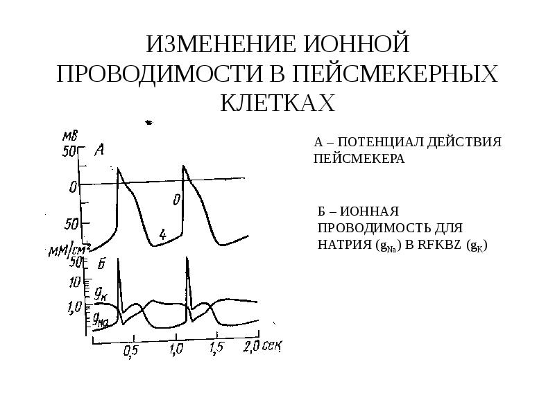 Пейсмекер