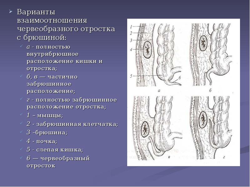 Особенности клинической картины острого аппендицита при тазовом расположении червеобразного отростка