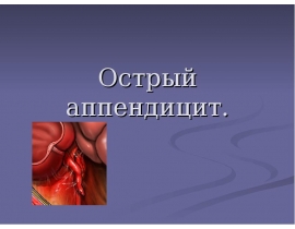 Острый аппендицит