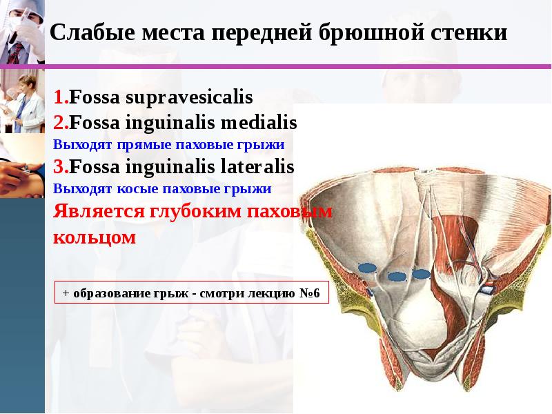 Слабые места. Слабые места брюшной стенки. Места передней брюшной стенки. Слабые места передней брюшной. Топография слабых мест передней брюшной стенки.