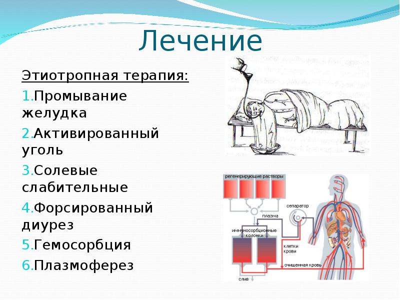 Схема форсированного диуреза