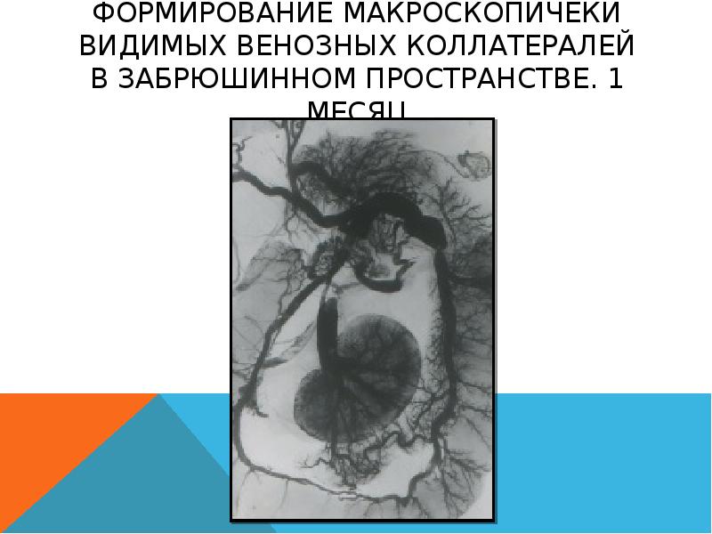 Коллатеральный отек. Проблема коллатерального кровообращения. Мероприятия способствующие развитию коллатералей. Извитые венозные коллатерали матки.