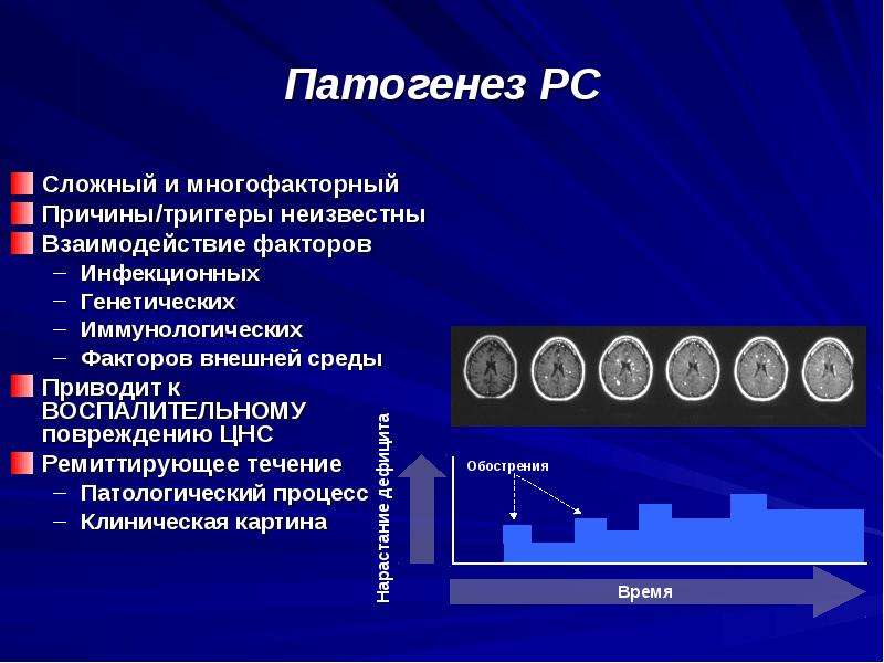 Рассеянный склероз патогенез схема